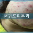 효근카클리닉 | 서귀포피부과 필수지식정보모음