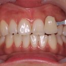 청담미소밝은치과의원 이미지