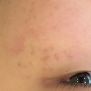 홍제뷰티샵 | 홍제역 디디뷰티 색소 관리 방문 후기