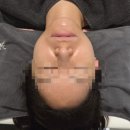 뷰-티나(뷰-Tina) | 목포경락 목포웨딩관리 끌리메 목포점 작은 얼굴 관리 솔직 후