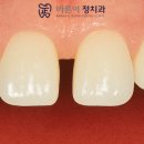 클리어치과기공소 이미지