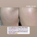 TM유통 | &lt;마감&gt; 러블립진 모공앰플, 미스트 2+1 파격 오픈!★