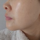 뉴셀팜 | 겨울철 피부관리는 위한 뉴셀팜 힐 바이 네이처 미스트