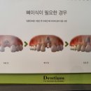 우리연합치과의원 네이버블로그