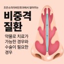 조은소리이비인후과에서 알려주는 비중격 질환 약물로 치료가 가능한 경우와 수술이 필요한 경우