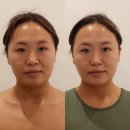 제이윤 에스테틱 | [방화역에스테틱] 두골비 윤곽관리가 이렇게 색다를 줄이야? 제이윤에스테틱 솔직후기