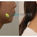 이종훈치과교정과치과의원 이미지