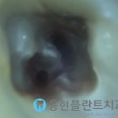 용현치과기공소 이미지