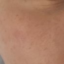 뽀송 | [전주 에스테틱] 전주 윤곽관리, 리프팅 맛집 "뽀송에스테틱"리얼 후기 들고 왔지요!