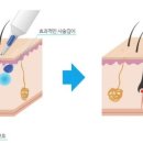 참예쁜의원 이미지