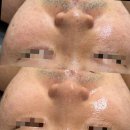 광주피부관리 글리나뷰티에서 피부 건강한 아름다움을 찾았어요.