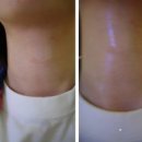 메이브리즈 이미지