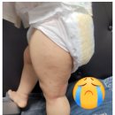 태소아청소년과의원 네이버블로그