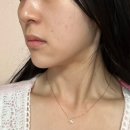 부산 서면피부과 추천 리프테라2 리프팅 내돈내산 후기