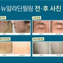 알라딘필링 이미지