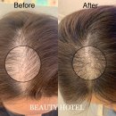 뷰티호텔 이미지