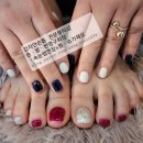 강자안손톱 이미지