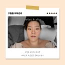 구월동 피부관리 문더샵 예비신부 작은얼굴 윤곽관리 후기
