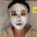 면포차 | 울트라 클리어 레이저 1일차 솔직 후기｜당일 상태 다운타임 통증 세안 가격