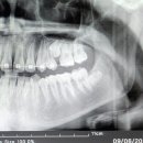 가지런이치과교정과치과의원 이미지