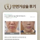 빌리프성형외과 네이버블로그