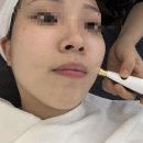 대전서구피부관리 쥬쥬뷰티크 피부관리 솔직 후기