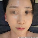 월곡 | 환절기 피부 월곡동피부관리 올가드림뷰티 월곡점 솔직 후기