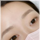 아미에헤어존