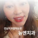 미소준치과의원 | 강남치과잘하는곳 뉴엔치과 퍼스널라미 찐 후기!