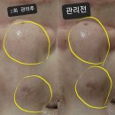 셀코패키지 이미지