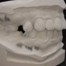 다치과기공소 이미지