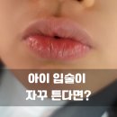 자연요법 | 아이 입술이 자꾸 튼다면? 립글로스 대신 해본 자연 민간요법 후기
