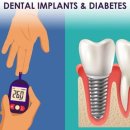 성환서울의원 | 천안 두정·성환 치과 – 당뇨 있어도 가능한 임플란트 기준 (당화혈색소 7.0 미만)