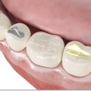 누가치과의원 이미지