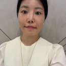 땅콩짐 | 강남 피부과 관자놀이 스컬트라 볼륨 땅콩형 얼굴 개선 효과 후기
