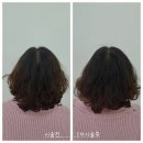 SMP두피 후기｜정관 ‘다트:미’ 3회차 받고 머리숱 걱정 끝!