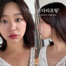 강남펫스타일 | 이중턱정리 강남온다리프팅 6만줄 후기(+슈링크유니버스 300샷, 제로펫주사)