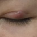 올바른안과의원 이미지