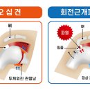 애룰바디 이미지