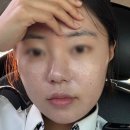 삼천포피부관리실바이엘 네이버블로그