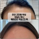 레니엘 | ☆안산 중앙동&amp;고잔동 왁싱 임산부 및 웨딩 왁싱 추천 오늘도 빛나 헤어라인 왁싱 후기