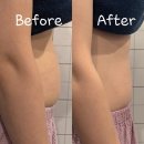 유연바디랩 | 퀵바디상체관리 잘하는 강릉에스테틱 '클라리스스킨랩 내곡자이점'