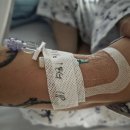 타투 복싱 | 서울아산병원 갑상선암 전절제 후기🥹