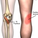 해맞이한의원 | 송우리 해맞이 한의원 추천함 (동네 단골후기)
