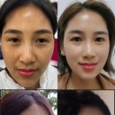 인셀덤블랙
