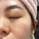 팔자주름패치 내돈내산 재구매 추천 후기