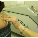 휴먼레이저 이미지