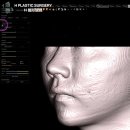 노블캣 | 귀족수술 노블캣의 자주하는질문과 당부사항