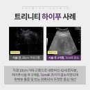 트리니티여성의원 네이버블로그