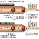 방사선 치료 후 합병증을 고압산소요법으로 이미지